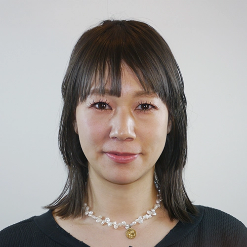 フラクショナルRF施術を受ける前の鹿沼様40代