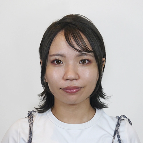 フラクショナルRF施術を受けた後の夏乃様20代