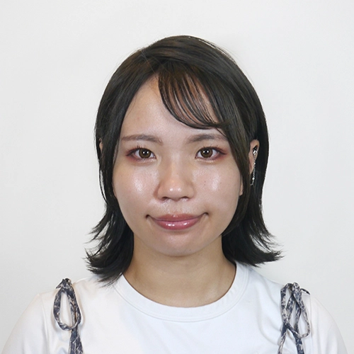 フラクショナルRF施術を受ける前の夏乃様20代