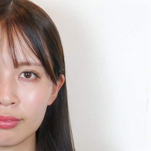 ハイドラフェイシャル施術を受ける前の渡辺様20代