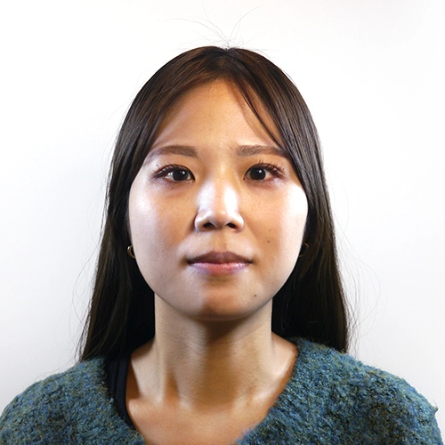 小顔矯正施術を受けた後の石川様30代