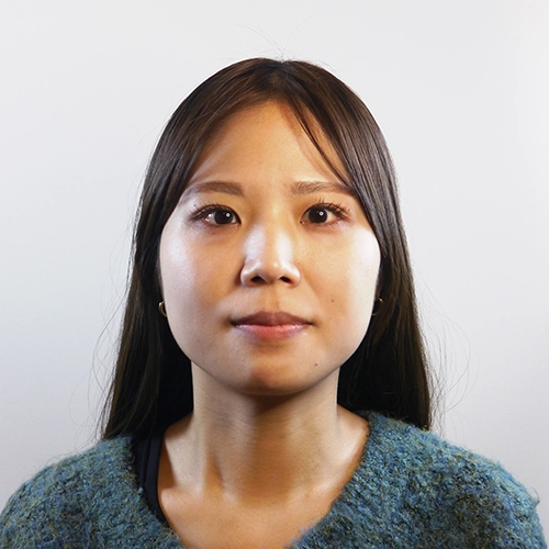 小顔矯正施術を受ける前の石川様30代